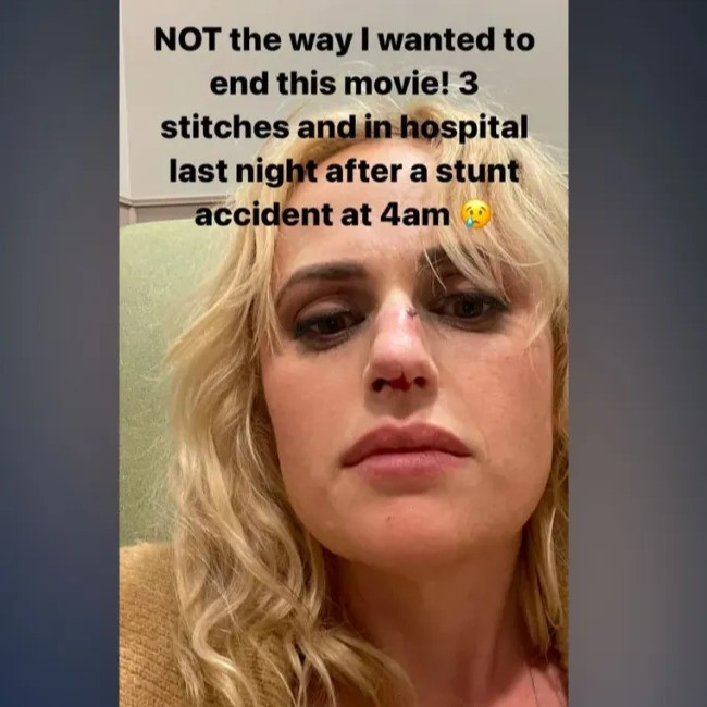 Rebel Wilson needed stitches after 'stunt accident'